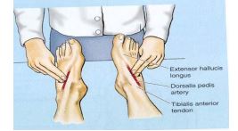 Senam Kaki Diabetes : Solusi Sederhana untuk Meningkatkan Sensitivitas Kaki Lansia Penderita Diabetes Mellitus Tipe 2